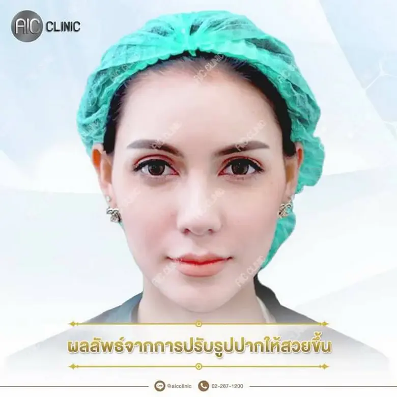 'ริมฝีปาก’ ถือเป็นจุดสำคัญของใบหน้า ที่มั...