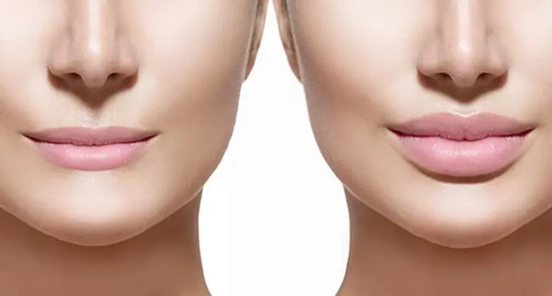 ศัลยกรรมหน้าอย่างไร ให้ปัง!! ไม่พัง! ไม่โป๊ะ!