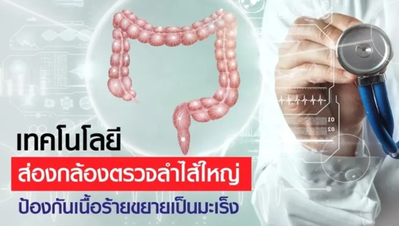 เทคโนโลยีส่องกล้องตรวจลำไส้ใหญ่ ป้องกันเน...