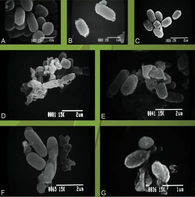 ม.มหิดล วิจัยลดติดเชื้อดื้อยาในรพ. มุ่งเป้ารักษาตรงจุด