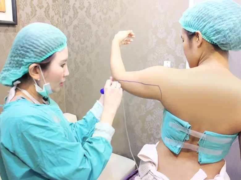 คุณหมอแนะก่อนดูดไขมันต้องเช็คให้ชัวร์ ความปลอดภัยต้องมาก่อน