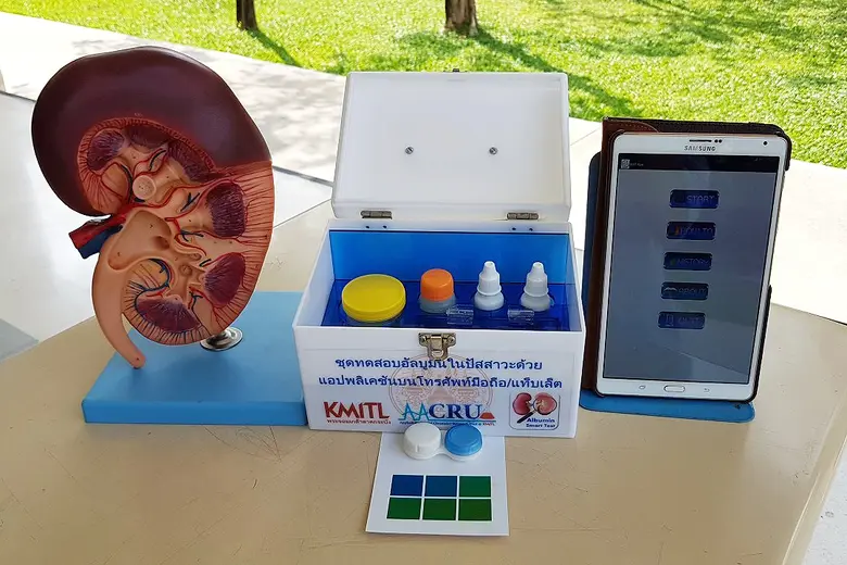 รู้เร็วรักษาเร็ว ! มูลนิธิ รพ.พระจอมเกล้า...