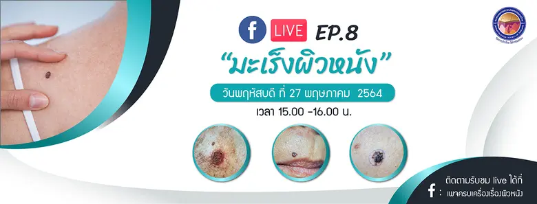 สมาคมแพทย์ผิวหนังฯ เชิญรับชมเพจเฟซบุ๊ก "ครบเครื่องเรื่องผิวหนัง"  EP.8 ตอน "มะเร็งผิวหนัง"