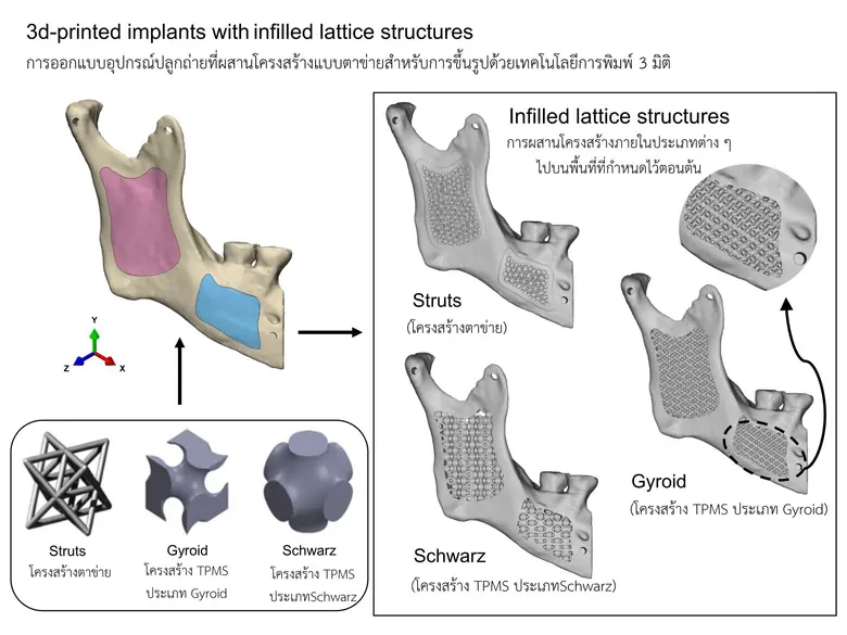 ในปัจจุบันเทคโนโลยีการพิมพ์ 3 มิติเข้ามาม...