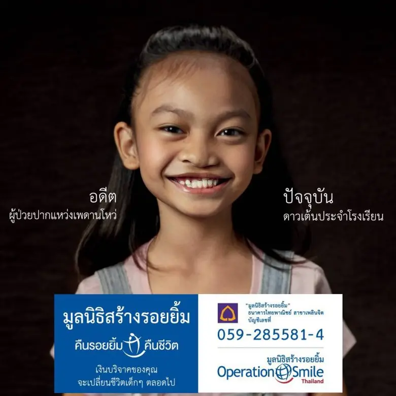 มูลนิธิสร้างรอยยิ้ม (Operation Smile Foundation)