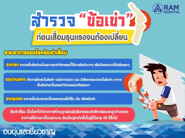 สำรวจ "ข้อเข่า" ก่อนเสื่อมรุนแรงจนต้องเปล...