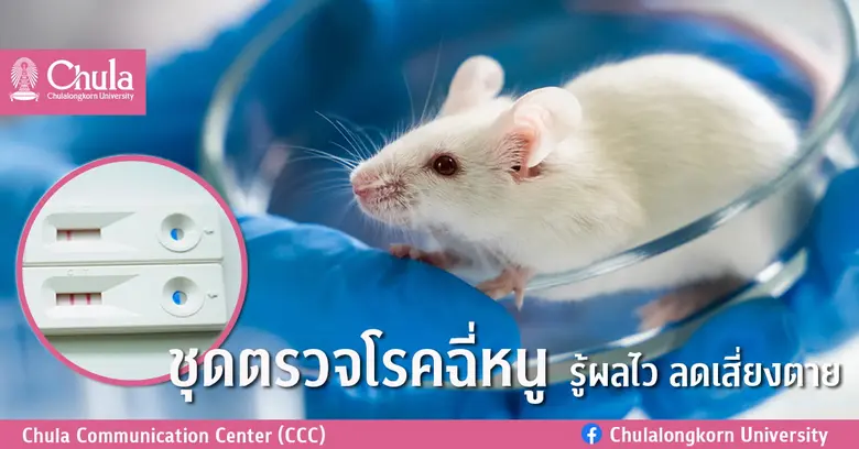 แพทยศาสตร์ จุฬาฯ เปิดตัวชุดแถบตรวจโรคฉี่ห...