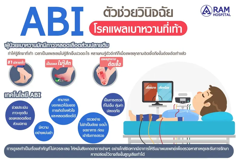 ABI ตัวช่วยวินิจฉัย "โรคแผลเบาหวานที่เท้า...
