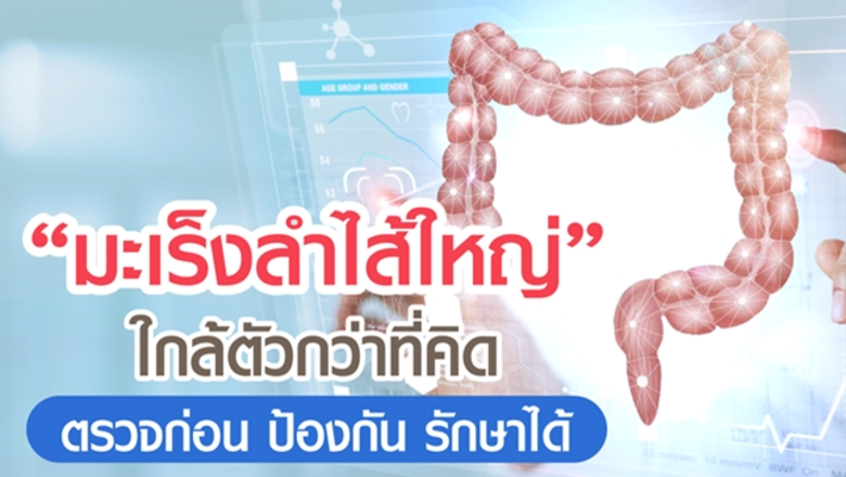 "มะเร็งลำไส้ใหญ่" ใกล้ตัวกว่าที่คิด ตรวจก...