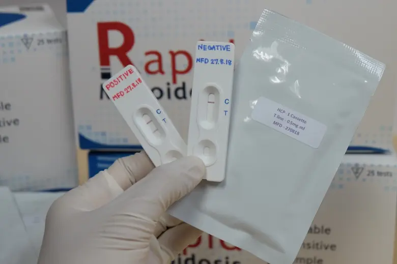 ม.มหิดล คิดค้นนวัตกรรมชุดตรวจโรคติดเชื้อเมลิออยโดสิส แม่นยำมาตรฐานระดับโลก