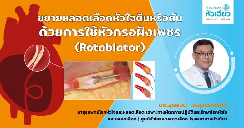 หลอดเลือดหัวใจ มีความสำคัญอย่างมากต่ออวัย...