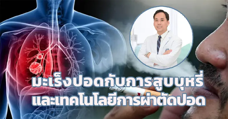 อย่างที่เราทราบกันว่า ทุกวันที่ 31 พฤษภาค...
