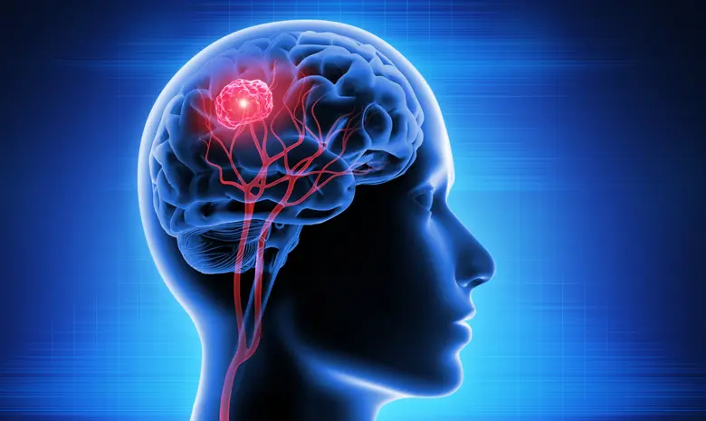 Brain cancer is one of the diseases with ...
