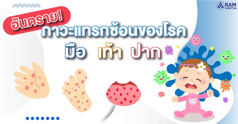 "มือ เท้า ปาก" เป็นโรคที่พบบ่อยในเด็กทารก...
