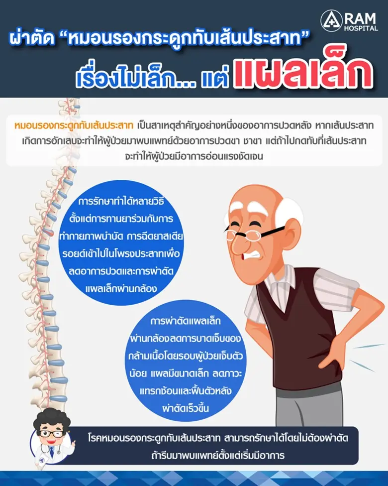 หมอนรองกระดูกทับเส้นประสาท เป็นสาเหตุสำคั...