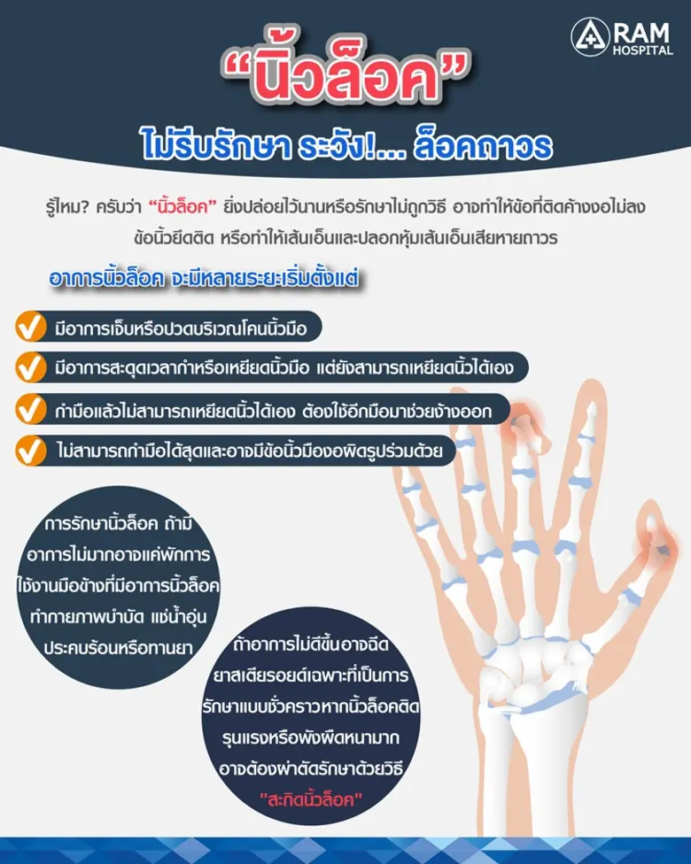 หลายคนคิดว่านิ้วล็อค เป็นแค่โรคที่รบกวนกา...