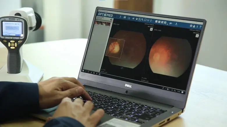 เอ็นไอเอรุกใช้นวัตกรรมลดความเสี่ยงผู้ป่วยเบาหวานไทย โชว์ 2 เทคฯ - ผลิตภัณฑ์พิชิตปัญหาเบาหวานให้เป็นเรื่องเบาหวิว