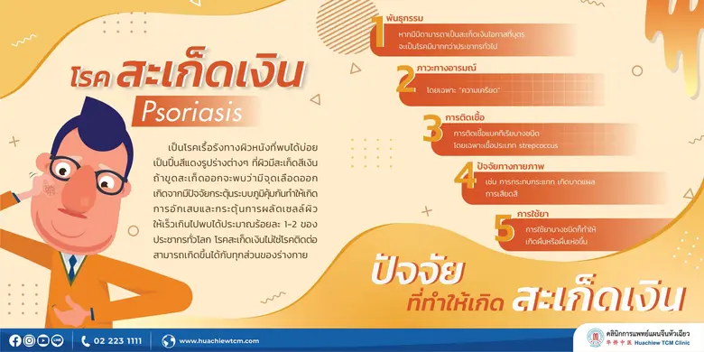 โรคสะเก็ดเงิน (Psoriasis) มีอีกชื่อว่า "เ...