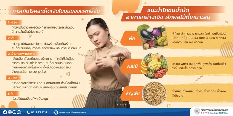 รู้จักโรคสะเก็ดเงิน (Psoriasis) ป้องกันและรักษาด้วยวิธีแพทย์แผนจีน โดย คลินิกการแพทย์แผนจีนหัวเฉียว