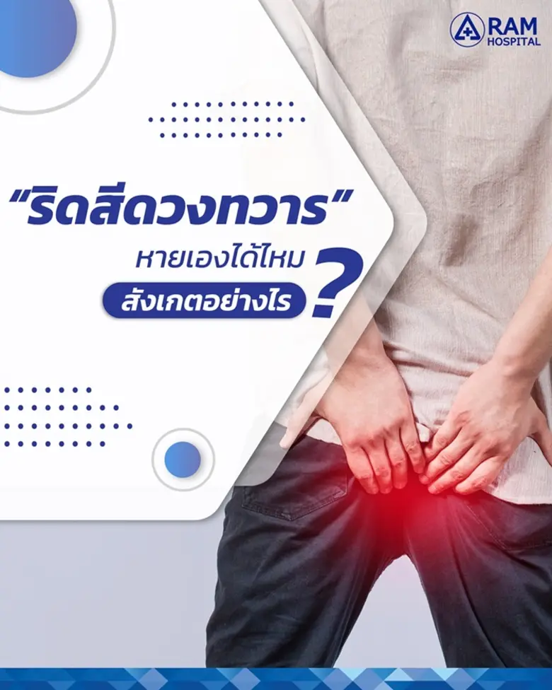 "ริดสีดวงทวาร หายเองได้ไหม?... สังเกตอย่า...