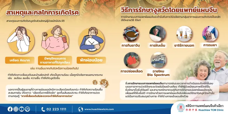 อาการปวดประสาทจากโรคติดเชื้อไวรัส งูสวัด รักษาได้โดยแพทย์แผนจีน