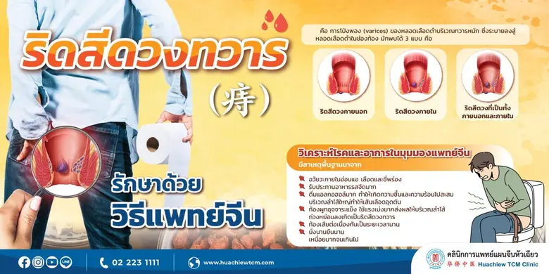 ริดสีดวงทวาร (? (?) คือ การโป่งพอง (varic...