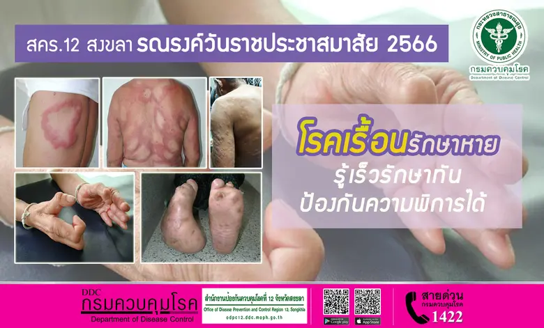 สำนักงานป้องกันควบคุมโรคที่ 12 จังหวัดสงข...