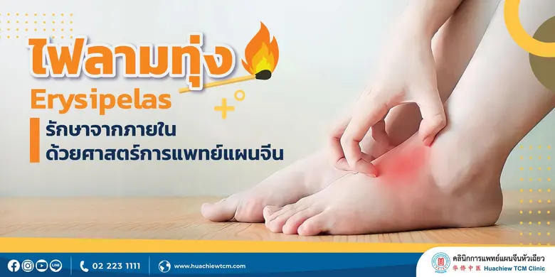 ไฟลามทุ่ง ในศาสตร์การแพทย์แผนจีนเรียกว่า ...