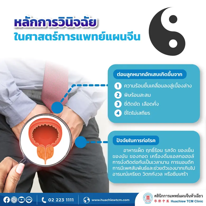 รู้ทัน "โรคต่อมลูกหมากอักเสบ" กับแพทย์แผนจีน โดย คลินิกการแพทย์แผนจีนหัวเฉียว