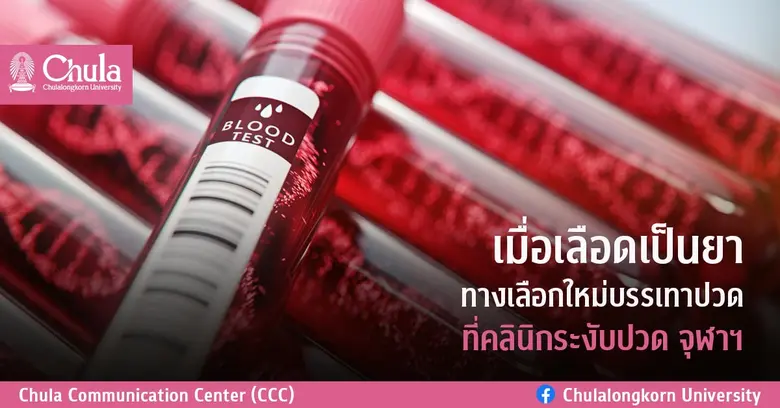 แพทย์จุฬาฯ วิจัยสำเร็จ ใช้เกล็ดเลือดเข้มข...