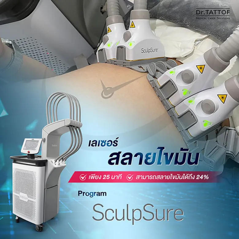กำจัดไขมัน ปั้นหุ่นให้ปัง! ด้วยโปรแกรม FAT Removal by Sculpsure
