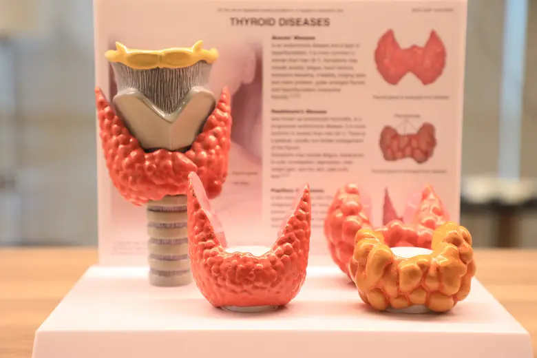 ไล่จับ!! 6 ภาวะโรคไทรอยด์ที่พบบ่อย ให้ทัน 'ก่อนเป็นพิษ' แม้ช้าเพียงนิด อาจเสี่ยง 'หัวใจวาย'