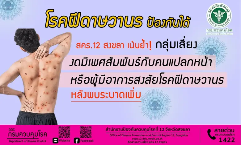 กรมควบคุมโรค เผยสถานการณ์โรคฝีดาษวานรมีแน...