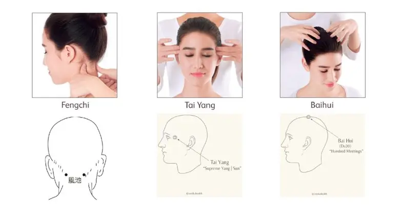 ไมเกรนแท้ ไมเกรนเทียม รักษาได้ด้วยแพทย์แผนจีน โดย คลินิกการแพทย์แผนจีนหัวเฉียว