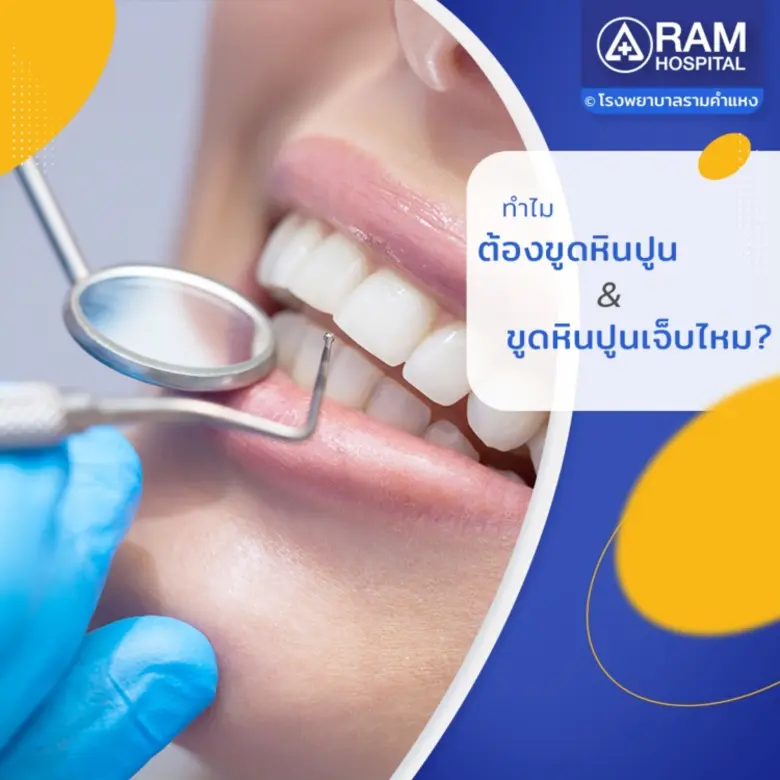 คราบหินปูน เกิดจากเชื้อแบคทีเรียรวมตัวกับ...