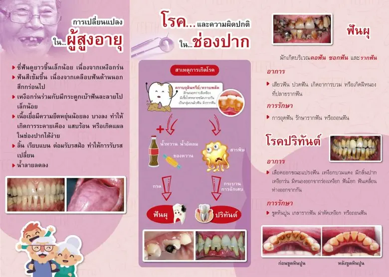 กทม.เร่งค้นหา-คัดกรองผู้สูงอายุในชุมชนกรุงเทพฯ รับบริการฟันเทียมและรากฟันเทียม