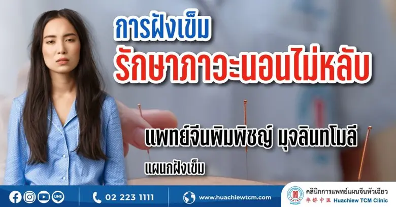 ภาวะนอนไม่หลับ หมายถึง ภาวะที่ร่างกายไม่ส...