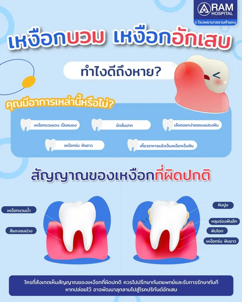 เหงือกบวม เหงือกอักเสบ ทำไงดีถึงหาย? คุณม...