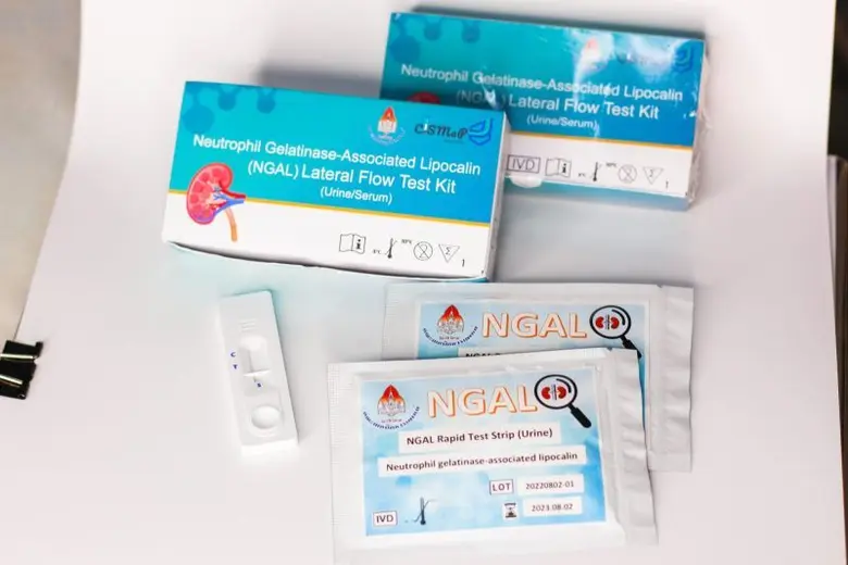 นักวิจัย มข.คิดค้นแถบตรวจวัดโปรตีน NGAL คัดกรองความผิดปกติของไตได้ภายใน 15 นาที ไตวายป้องกันได้! ด้วยตนเอง