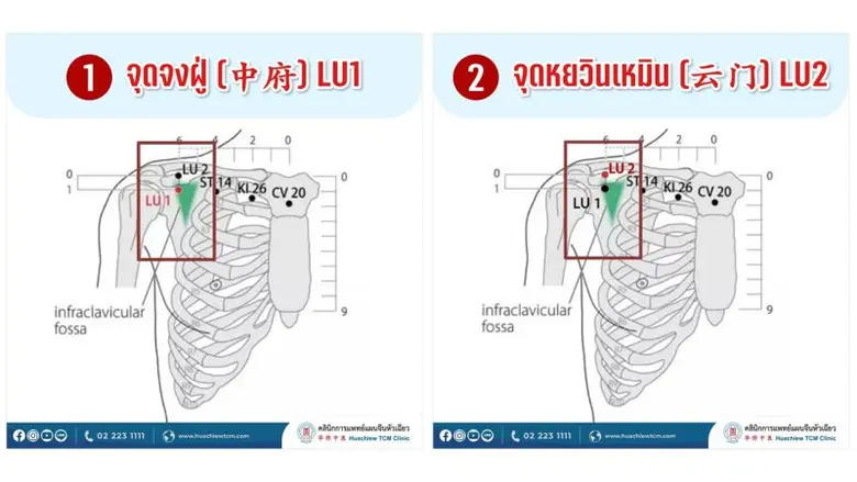 แพทย์จีนแนะกด 2 จุดหายใจสะดวก โดย คลินิกการแพทย์แผนจีนหัวเฉียว