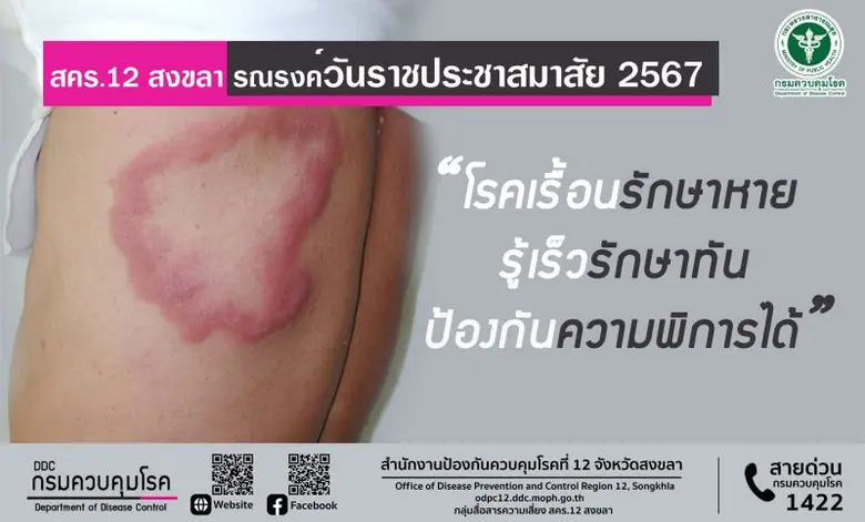 สำนักงานป้องกันควบคุมโรคที่ 12 จังหวัดสงข...