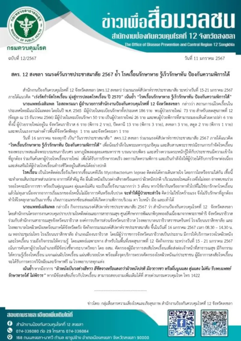 สคร. 12 สงขลา รณรงค์วันราชประชาสมาสัย 2567 ย้ำ โรคเรื้อนรักษาหาย รู้เร็วรักษาทัน ป้องกันความพิการได้