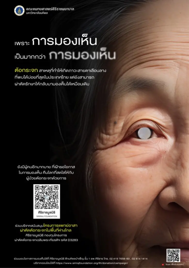 ต้อกระจก สาเหตุที่ทำให้เกิดภาวะสายตาเลือน...