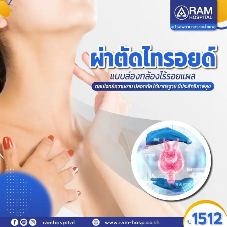 ผ่าตัดไทรอยด์แบบส่องกล้องไร้รอยแผล การผ่า...