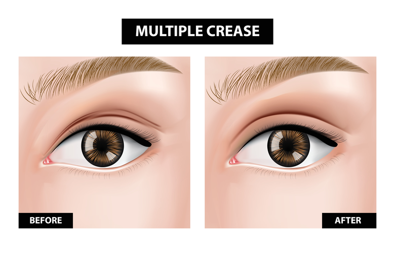 ดวงตาคู่สวยเป็นสิ่งที่สะท้อนความงดงามบนใบ...