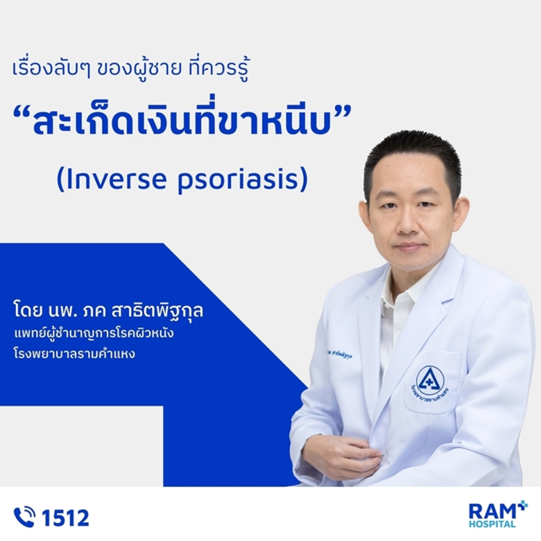 เรื่องลับๆ ของผู้ชาย ที่ควรรู้ : สะเก็ดเงินที่ขาหนี...